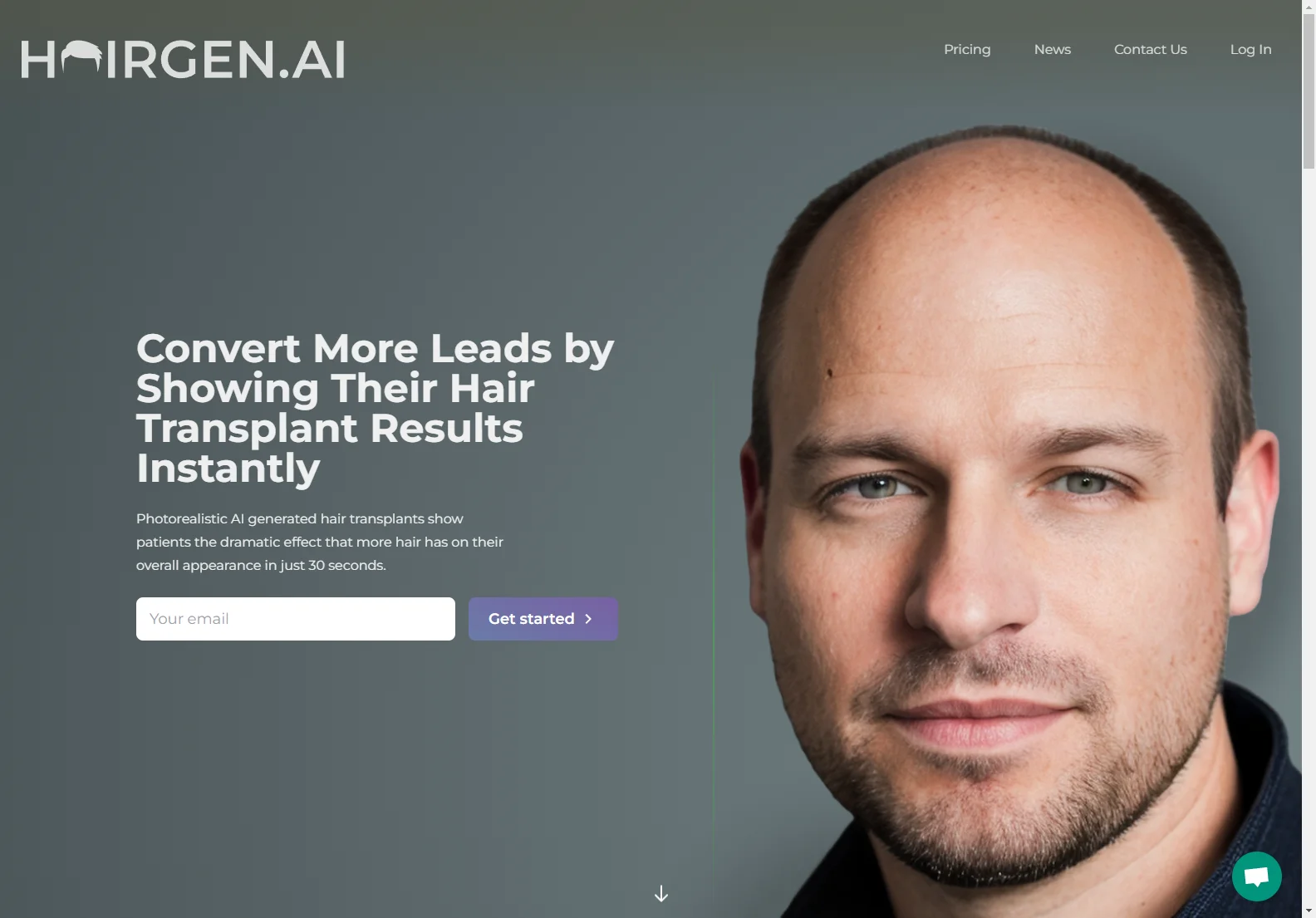 Hairgen.ai: AI-Powered Hair Transplant Previews for Increased Conversions